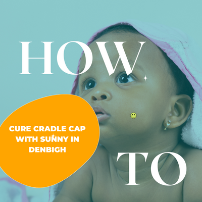 Managing Cradle Cap with Sunny In Denbigh: A Gentle Approach to Soothe Your Baby's Scalp